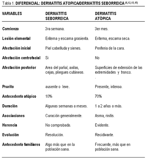 tabla